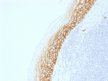 Recombinant CD44v9 Antibody / Rabbit Monoclonal