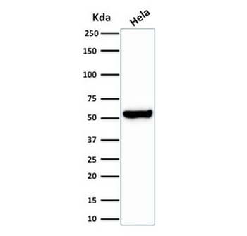 HSP60 Antibody