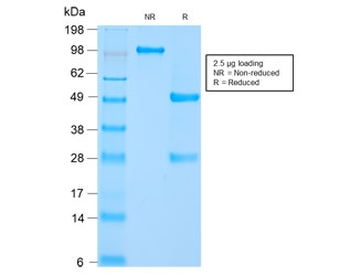 HSP60 Antibody