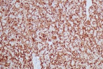 HSP60 Antibody