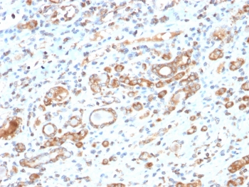 Recombinant HSP60 Antibody / Rabbit Monoclonal