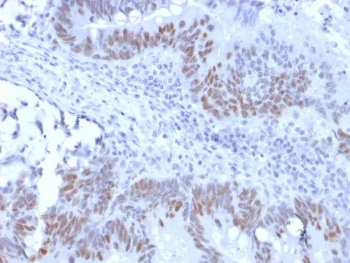 Recombinant RB1 Antibody / Rabbit Monoclonal