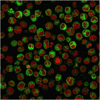 Recombinant CD79a Antibody