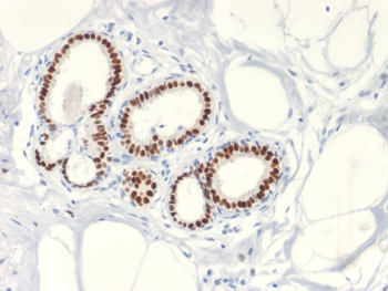 Recombinant Estrogen Receptor Antibody (alpha)
