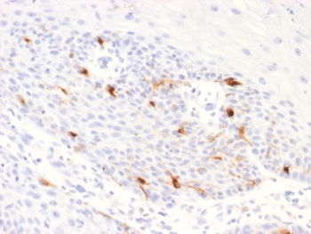 Recombinant TRP1 Antibody / Tyrosinase Related Protein 1 / TYRP1