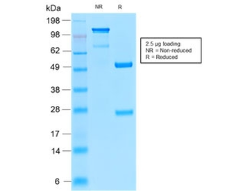 Recombinant Insulin Receptor alpha Antibody