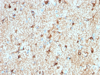 GFAP Antibody / Glial Fibrillary Acidic Protein