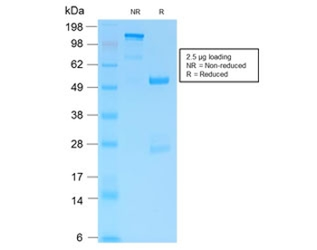 GFAP Antibody / Glial Fibrillary Acidic Protein