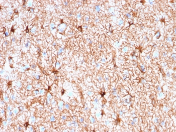 GFAP Antibody / Glial Fibrillary Acidic Protein