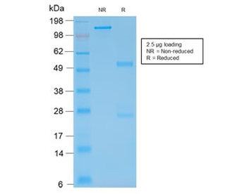 GFAP Antibody / Glial Fibrillary Acidic Protein