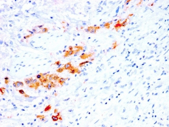 Recombinant CD44v4 Antibody