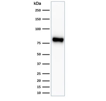 Beta Catenin Antibody