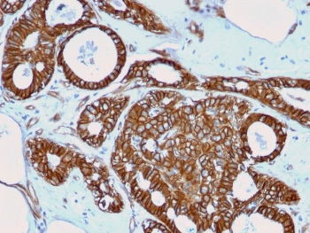 Recombinant Beta Catenin Antibody