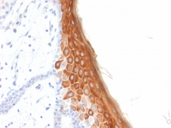 Recombinant KRT10 Antibody / Cytokeratin 10
