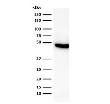 KRT19 Antibody / Cytokeratin 19