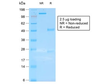 KRT19 Antibody / Cytokeratin 19