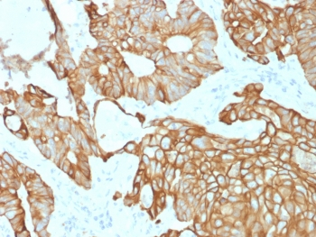 Recombinant CK19 Antibody / Cytokeratin 19