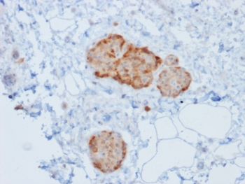 Recombinant CHGA Antibody / Chromogranin A