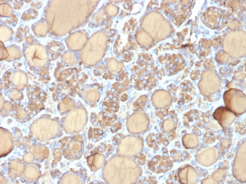 TG Antibody / Thyroglobulin