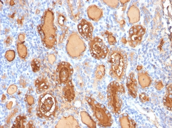 Recombinant Thyroglobulin Antibody / TG