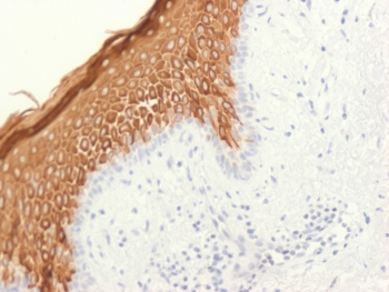 Recombinant CK10 Antibody / Rabbit Monoclonal