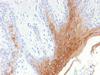 Recombinant Cytokeratin 10 Antibody / Rabbit Monoclonal