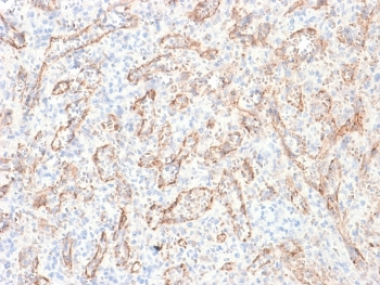 Recombinant TL1A Antibody / TNFSF15 / VEGI
