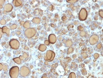 Recombinant TG Antibody / Rabbit Monoclonal