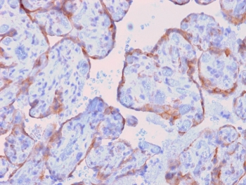 Recombinant MMP3 Antibody