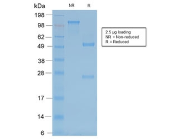 Neurofilament Antibody (-Heavy) / NF-H / NEFH