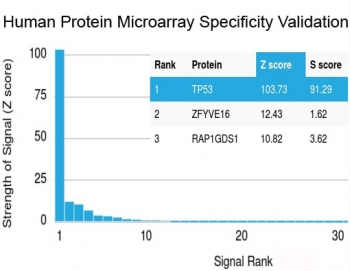 p53 Antibody / TP53