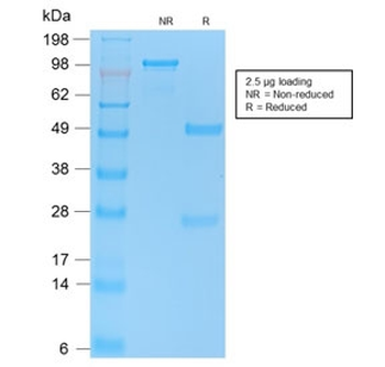 p53 Antibody / TP53