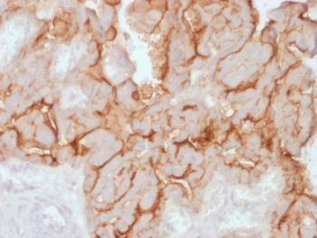 Recombinant MUC16 Antibody / Rabbit Monoclonal