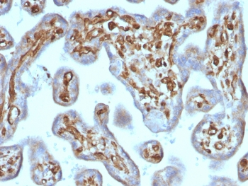 Recombinant Moesin Antibody