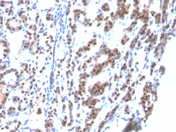Recombinant TTF-1 Antibody / NKX2.1
