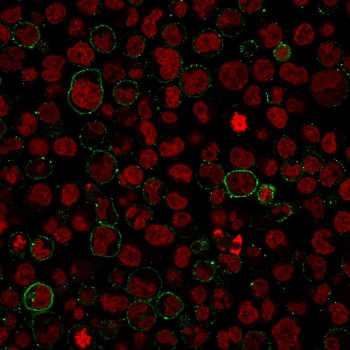 Recombinant CD45 Antibody / Rabbit Monoclonal