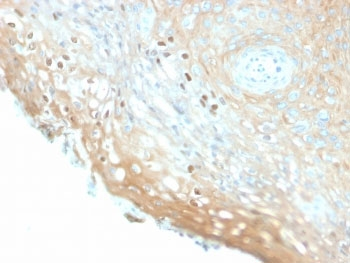 Recombinant HPV16 L1 Antibody / Rabbit Monoclonal