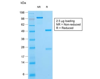 Recombinant HSV1 Antibody / Herpes Simplex Virus Type I