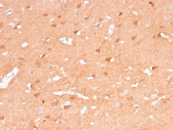Recombinant PGP9.5 Antibody