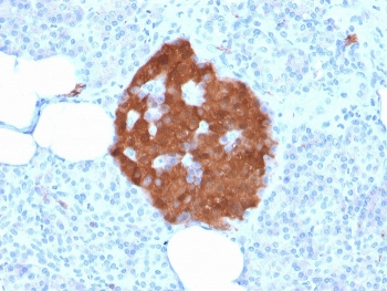 Recombinant PGP9.5 Antibody