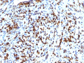Recombinant MyoD Antibody / Rabbit Monoclonal