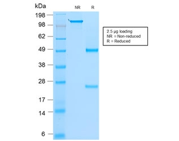 Recombinant MyoD1 Antibody