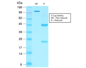 NKX2.2 Antibody
