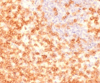Recombinant CD27 Antibody
