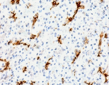Recombinant MUC6 Antibody / Gastric Mucin / Rabbit Monoclonal