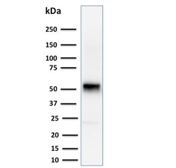 Cyclin E1 Antibody