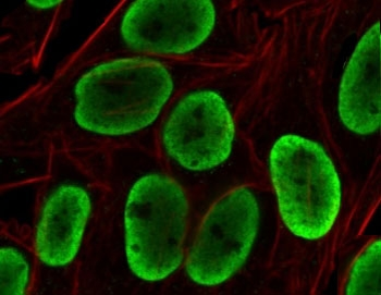 Recombinant Histone H1 Antibody / Rabbit Monoclonal