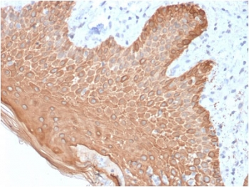 Recombinant Multi Cytokeratin Antibody