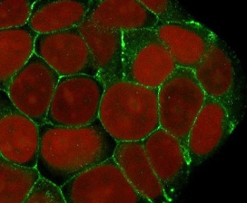 Recombinant E-Cadherin Antibody / Rabbit Monoclonal