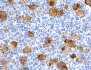 Recombinant CD30 Antibody